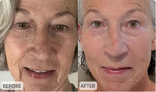Customer before and after