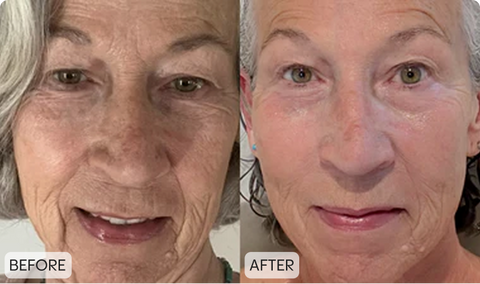 Customer before and after