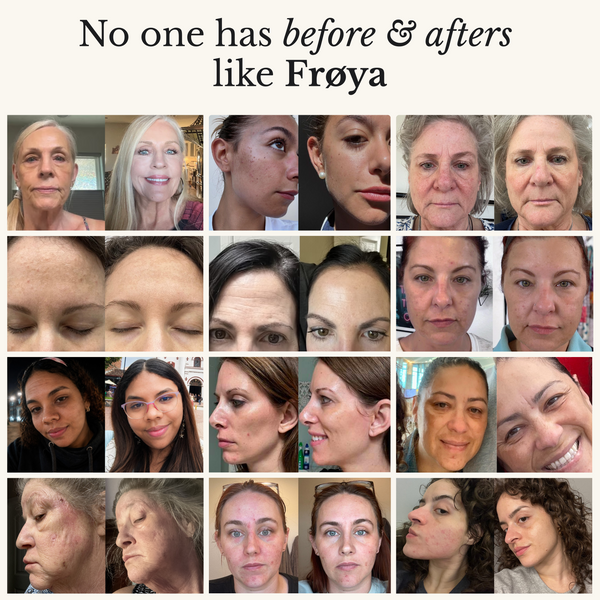 Frøya Organics Complete Mature Skin System — grid of customer before and after results